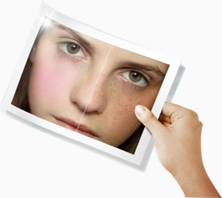 Cause of skin aging... UV rays